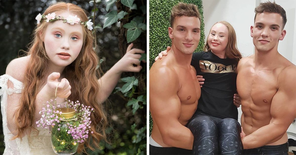 22-Year-Old Model With Down Syndrome Is Eager to Become a Victoria Secret Angel and Change the Face of Beauty 22-Year-Old Model With Down Syndrome Is Eager to Become a Victoria Secret Angel and Change the Face of Beauty