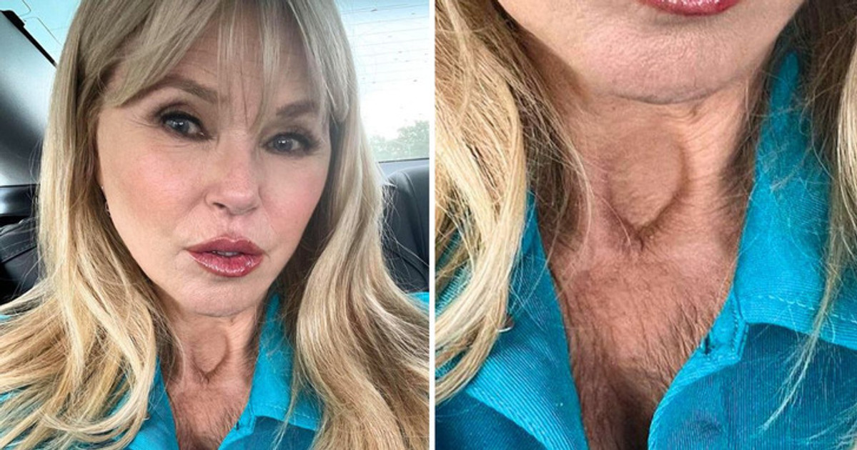 15 Women Who Proudly Reveal the Raw Reality of Aging
