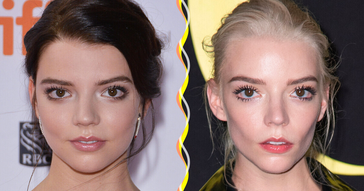 What 15 Famous Women Looked Like Before They Got Chiseled Cheekbones What 15 Famous Women Looked Like Before They Got Chiseled Cheekbones