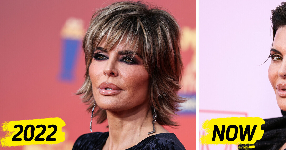 «She Ruined Her Face», Lisa Rinna’s Latest Appearance Shocks Fans «She Ruined Her Face», Lisa Rinna’s Latest Appearance Shocks Fans