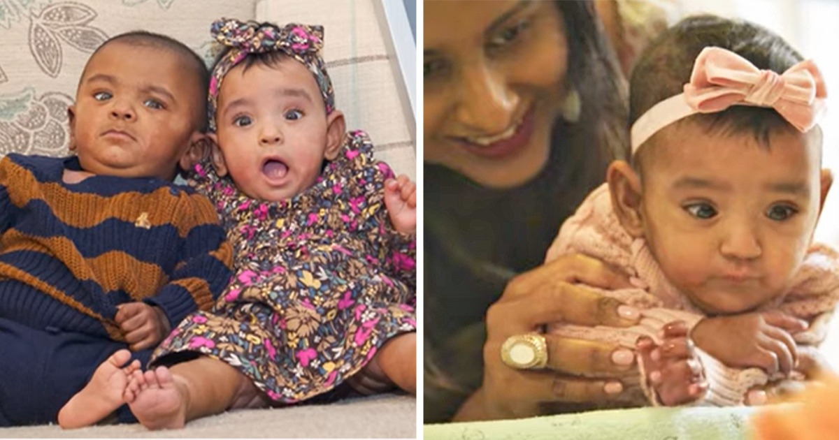 With a Zero Chance of Survival, These Twins Prove to Be the World’s Most Premature Miracle