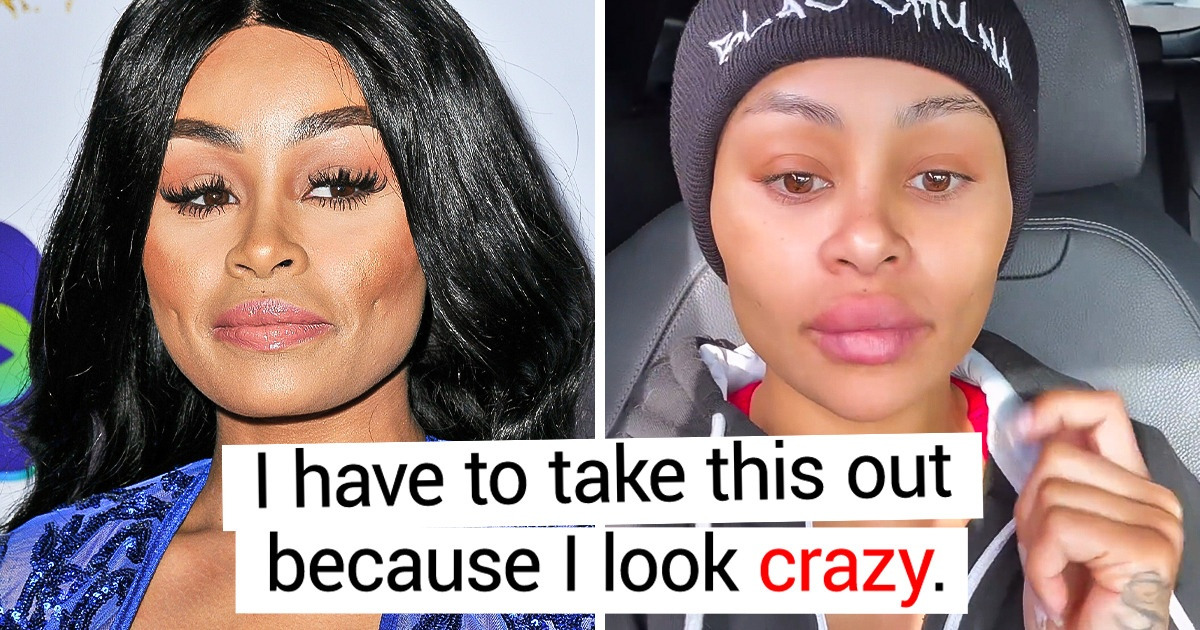 Why More and More Celebrities Are Deciding to Reverse Cosmetic Procedures Why More and More Celebrities Are Deciding to Reverse Cosmetic Procedures
