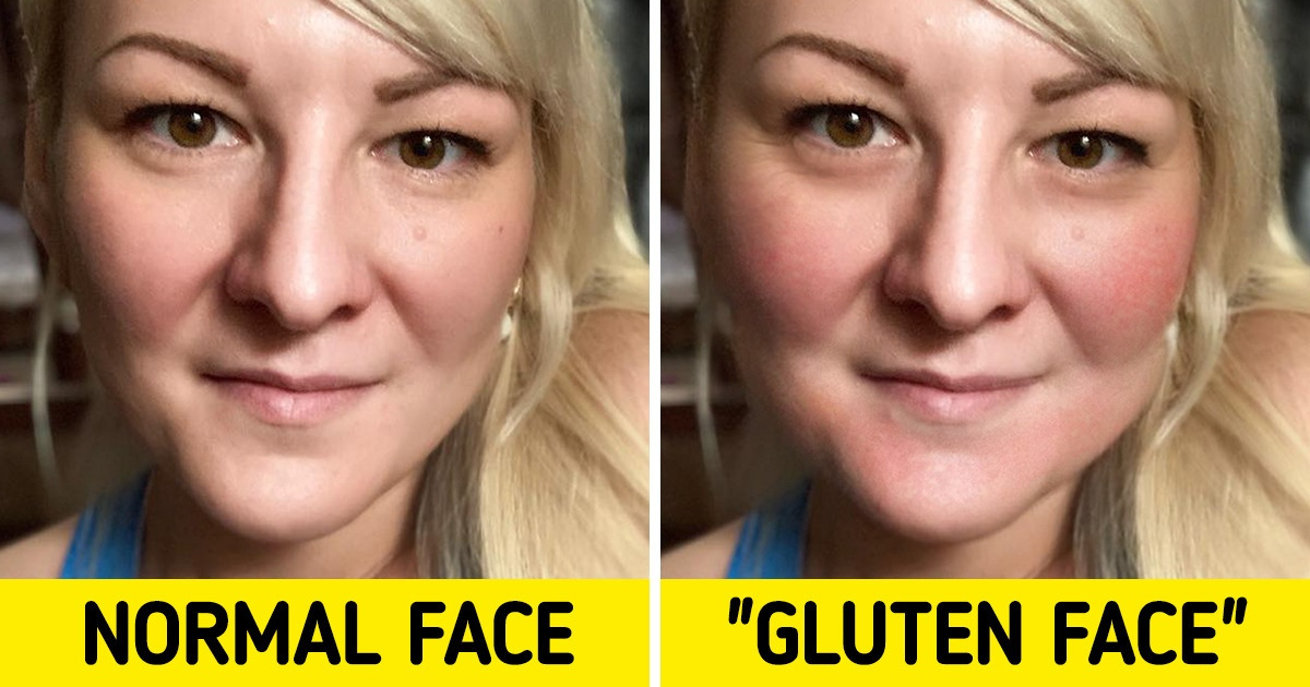 What Could Happen to You If You Reside Eating Gluten Entirely | DietDF thumbnail