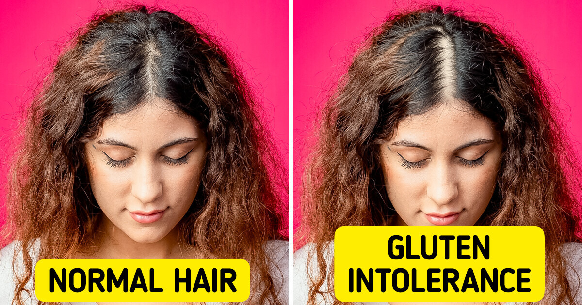 13 Strange Ways Your Body May Be Reacting to Gluten 13 Strange Ways Your Body May Be Reacting to Gluten
