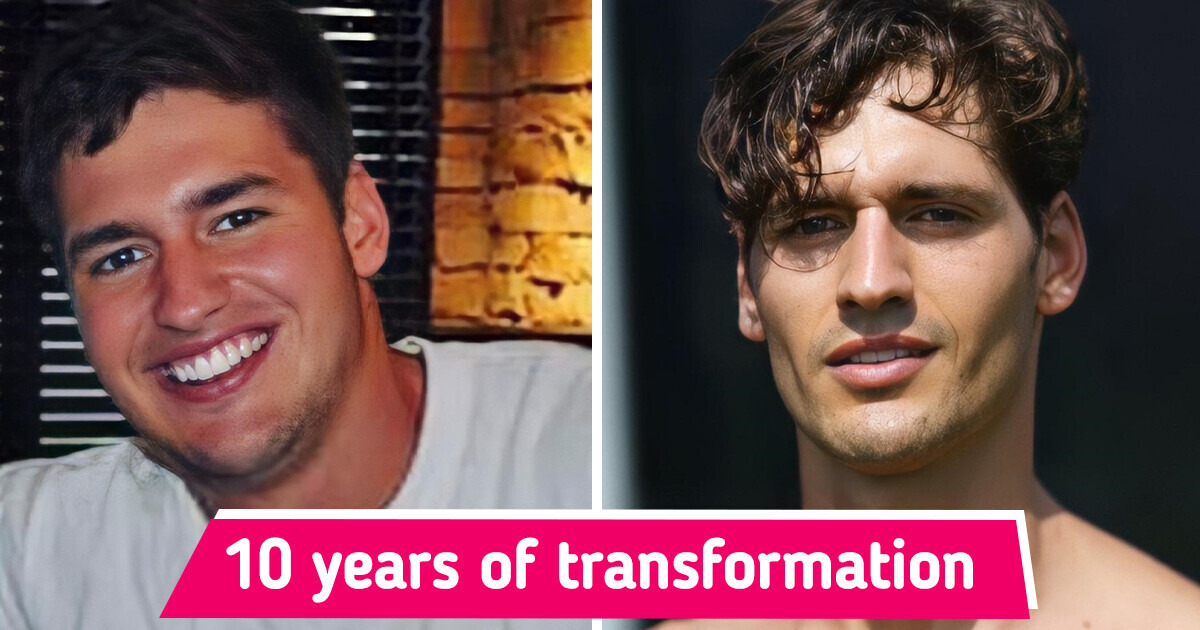 15 People Who Embrace Their New Looks With an Open Heart