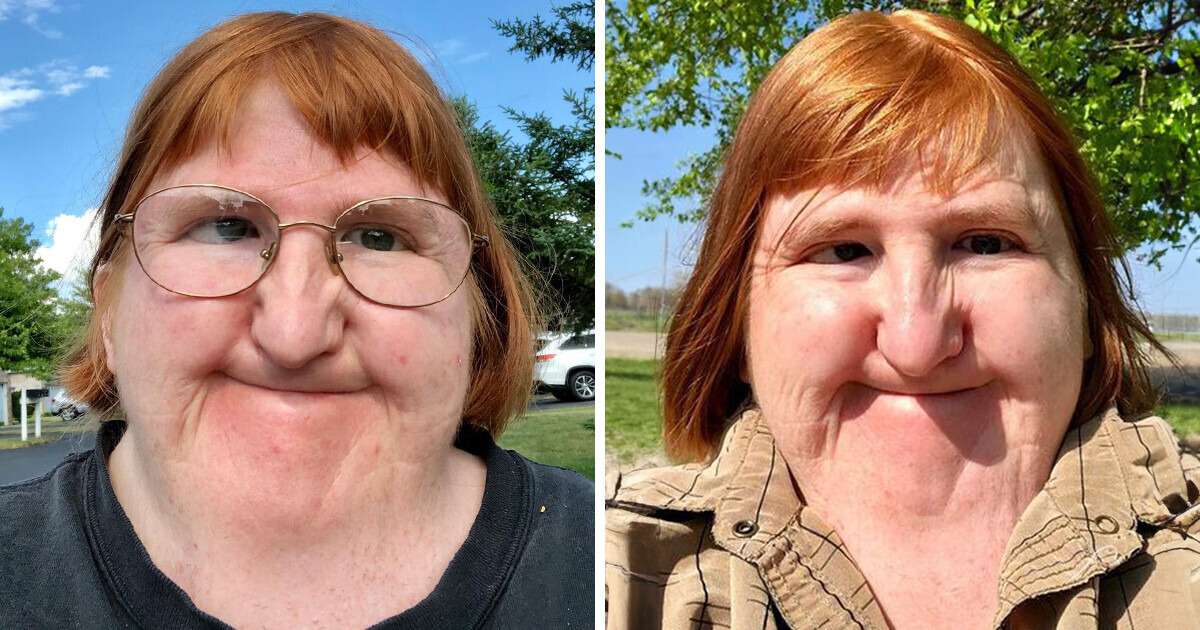 Melissa Was Bullied That She Is Too Ugly to Post Selfies, But She Became a Model Despite That Melissa Was Bullied That She Is Too Ugly to Post Selfies, But She Became a Model Despite That