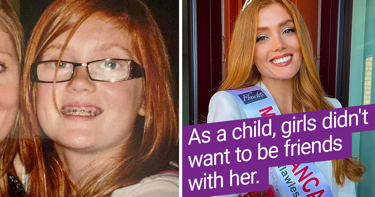 A Lady Who Faced Hardships for Her Ginger Locks Has Become the First Redhead to Be Crowned Miss England A Lady Who Faced Hardships for Her Ginger Locks Has Become the First Redhead to Be Crowned Miss England