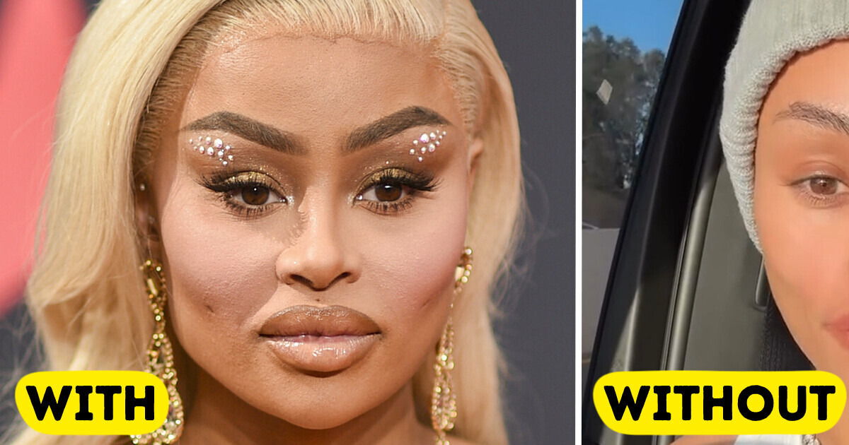 10 Celebrities Who Dissolved Their Fillers and Embraced Their Natural Look 10 Celebrities Who Dissolved Their Fillers and Embraced Their Natural Look