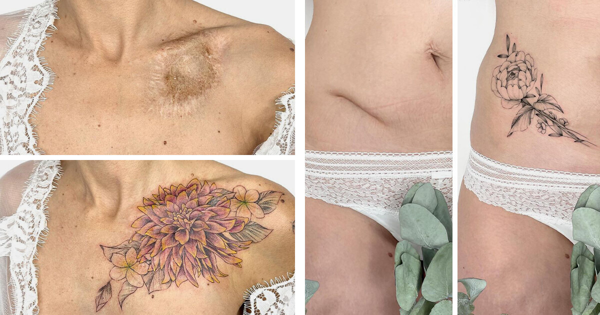 Tattoo Artist Breathes Life Into People’s Scars Making Them a Living Piece of Art