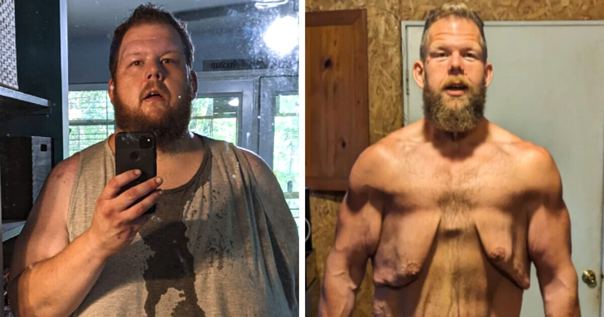 A Man Achieves a Remarkable 336lb Weight Loss and Receives an ...