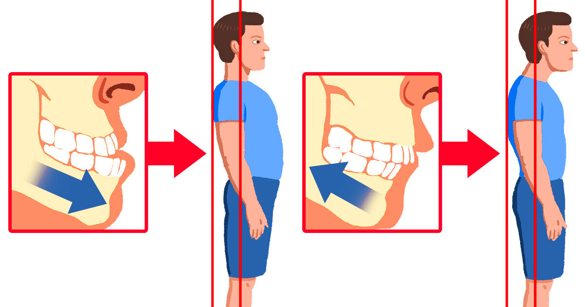 10 Easy Ways to Improve Your Posture, Plus One More Very Important Thing