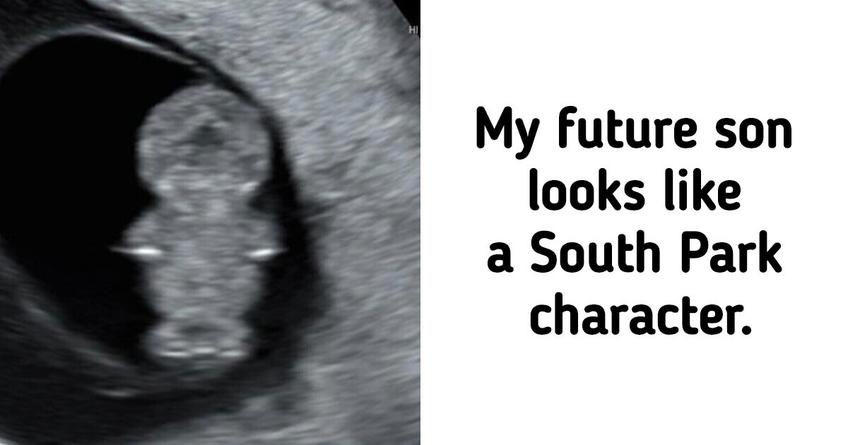 20 Pics That Will Show You How Ordinary Things Chose to Become Extraordinary