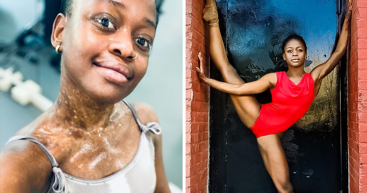 She Was Called the “Devil’s Child” in the Orphanage, How a Couple Adopted a Neglected Kid and Raised a World-Famous Ballerina