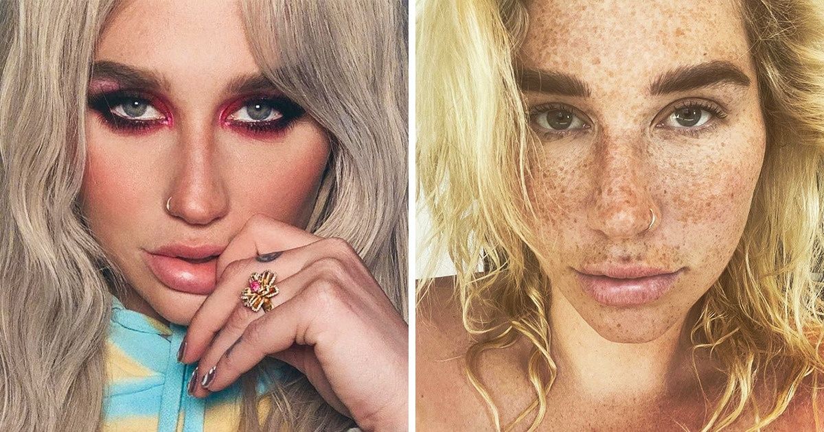 10 Times Celebrities Went 100 FilterFree