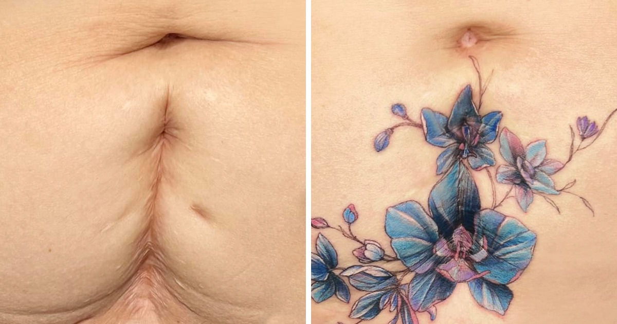 This Tattooist Charges People With Self-Confidence by Turning Their Wounds and Scars Into Blossoming Art