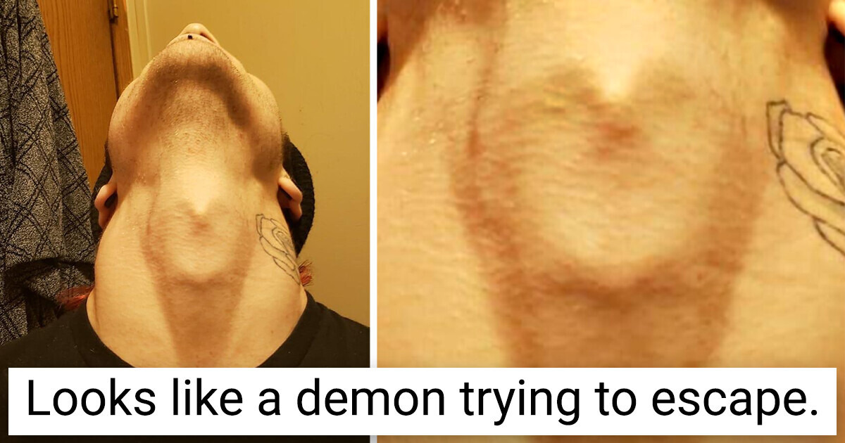 17 People Whose Body Full of Wonderful Treasures