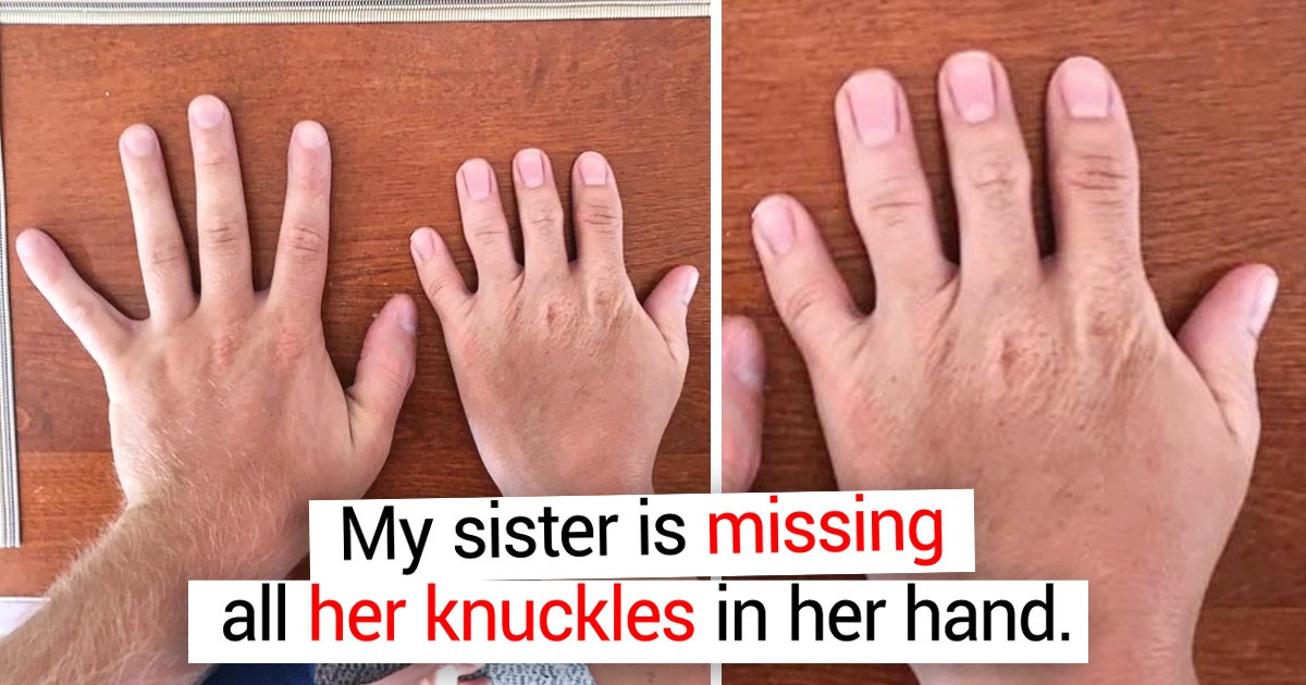 17 People and Animals Who Are So Special That We’d Want to Study Their Genes