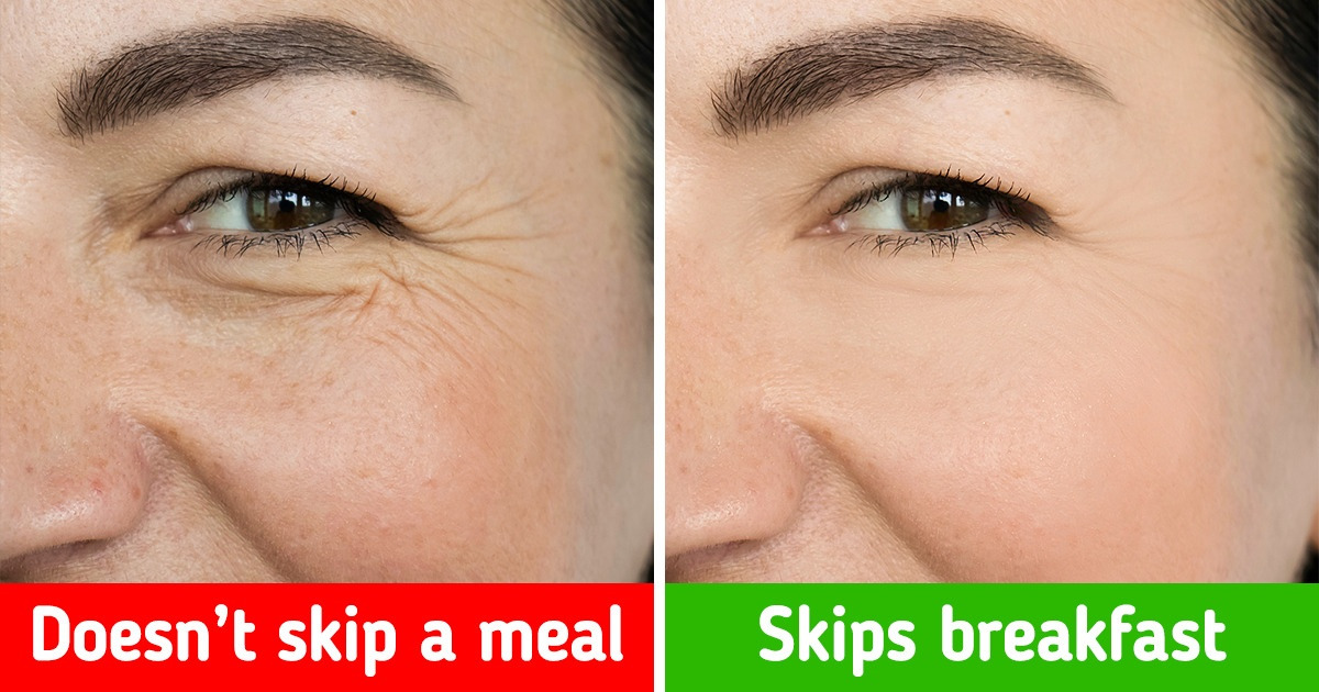 Use Rosemary to Get Rid of Grey Hair and 6 Other Tips to Help You Age Beautifully Use Rosemary to Get Rid of Grey Hair and 6 Other Tips to Help You Age Beautifully
