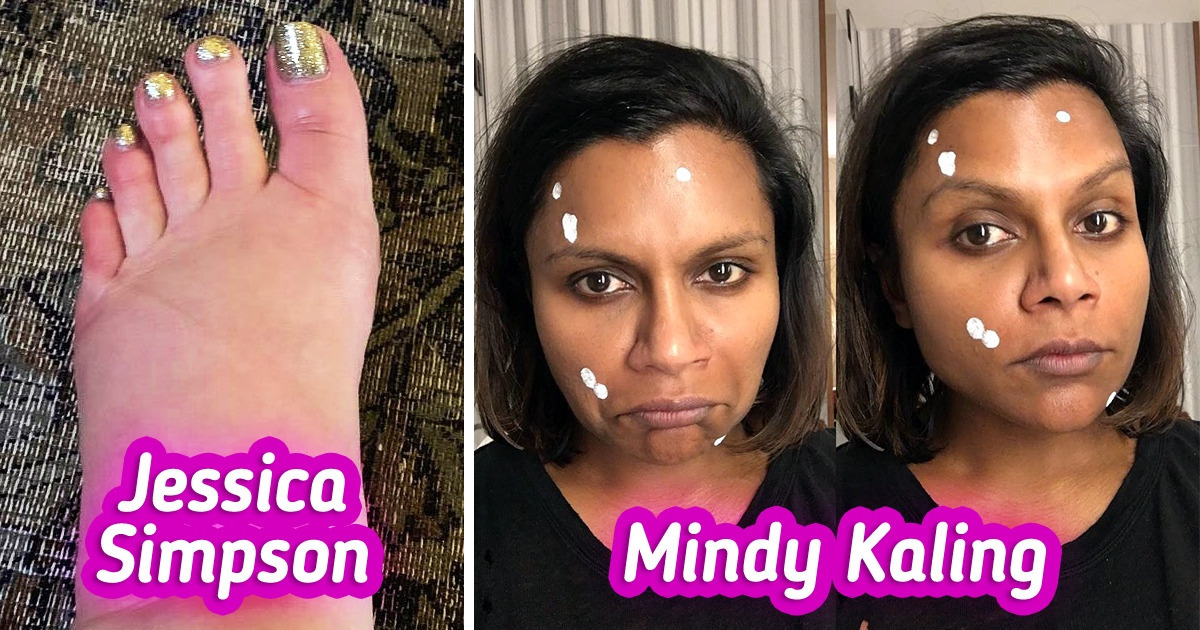 12 Times Celebrities Shared Untouched Photos to Reveal Life Without Filters