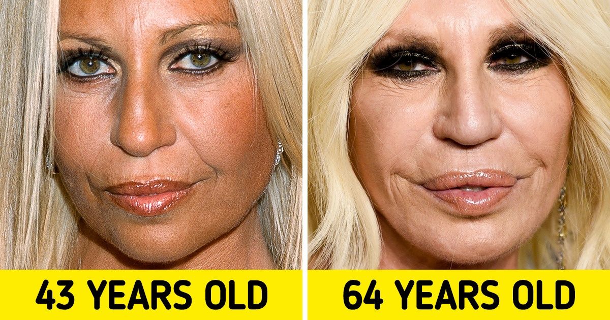 20+ Close-Ups of Celebrities That Show How They’ve Changed Over the Years 20+ Close-Ups of Celebrities That Show How They’ve Changed Over the Years