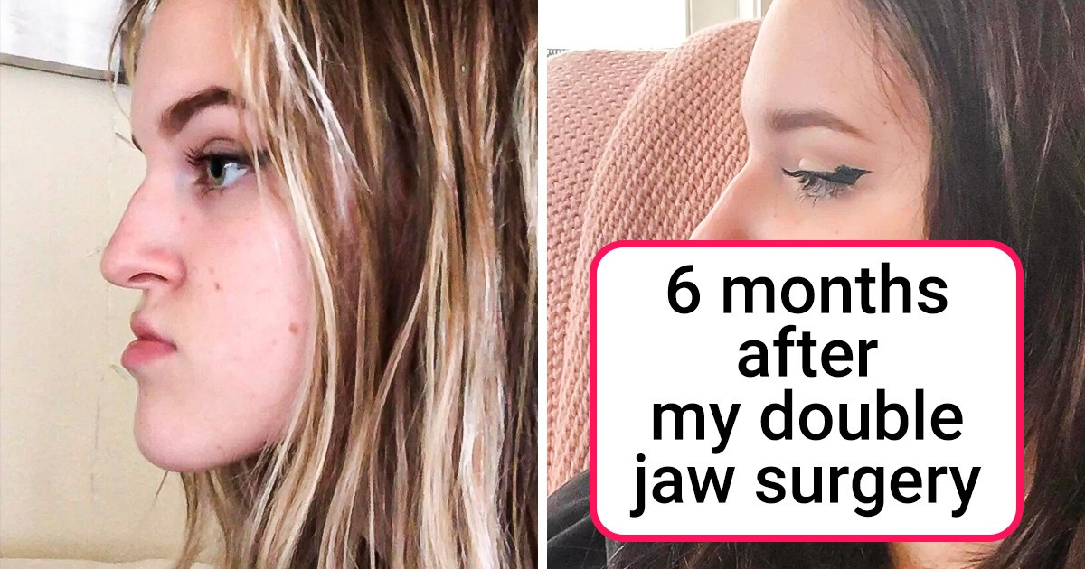 16 Photos That Perfectly Show What Progress Looks Like
