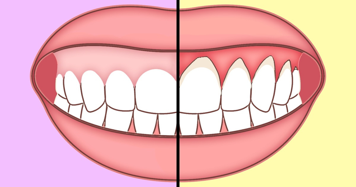6 Everyday Habits Your Teeth Will Thank You for Adopting 6 Everyday Habits Your Teeth Will Thank You for Adopting
