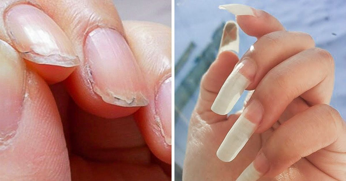 10 Natural Ways to Fix Your Brittle, Weak Nails / Bright Side