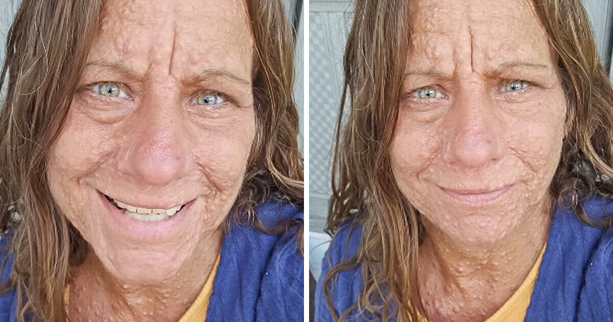 "These “Bumps” Are Not on My Skin," a Woman Speaks Up About Her Neurological Disorder "These “Bumps” Are Not on My Skin," a Woman Speaks Up About Her Neurological Disorder