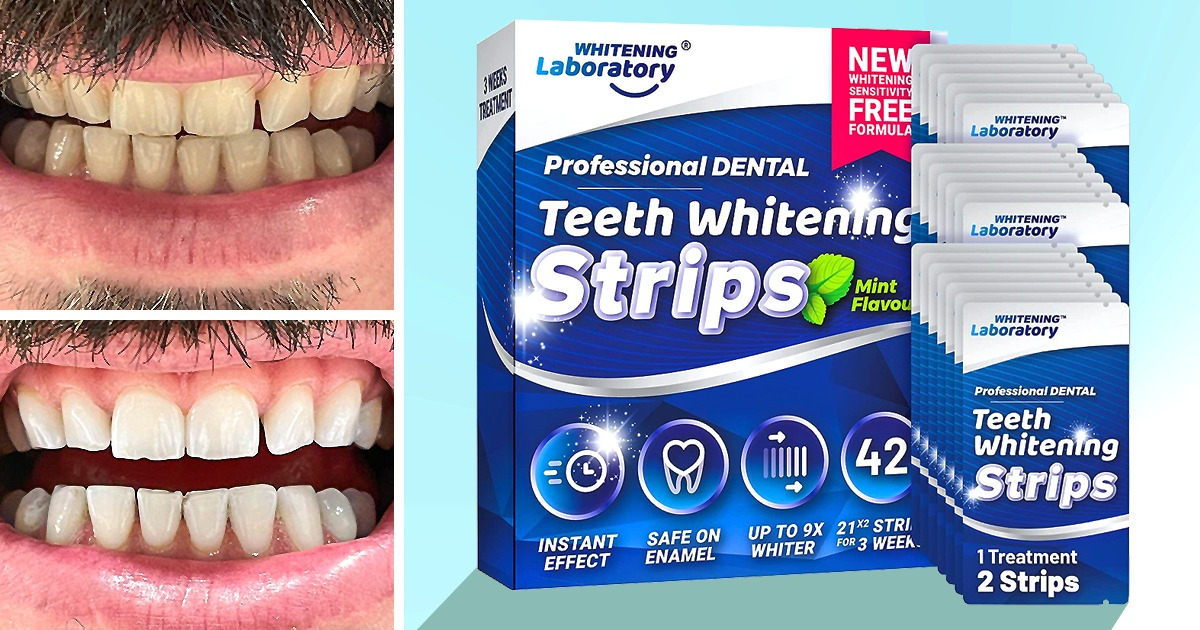 53 Discounted Things That Will Make You Say, “It Was Well Worth My Money!”