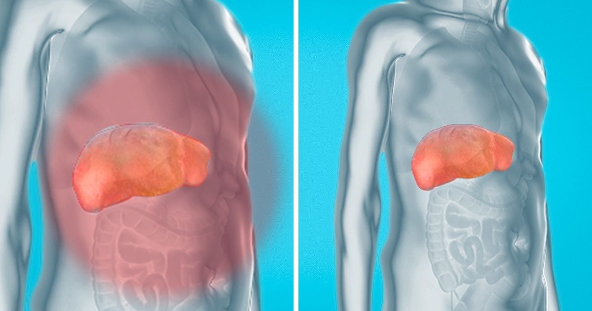 How to Remove Toxins From Your Liver, Kidneys, and Bladder Naturally and Gently