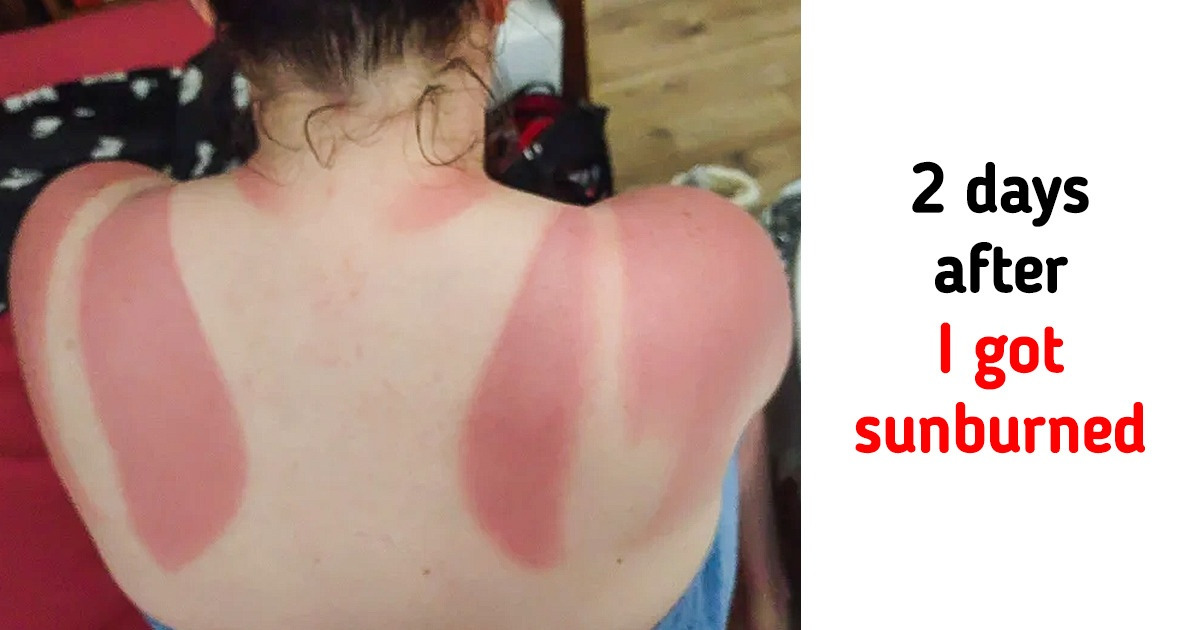 18 Unlucky Moments You Wouldn’t Wish on Anyone 18 Unlucky Moments You Wouldn’t Wish on Anyone