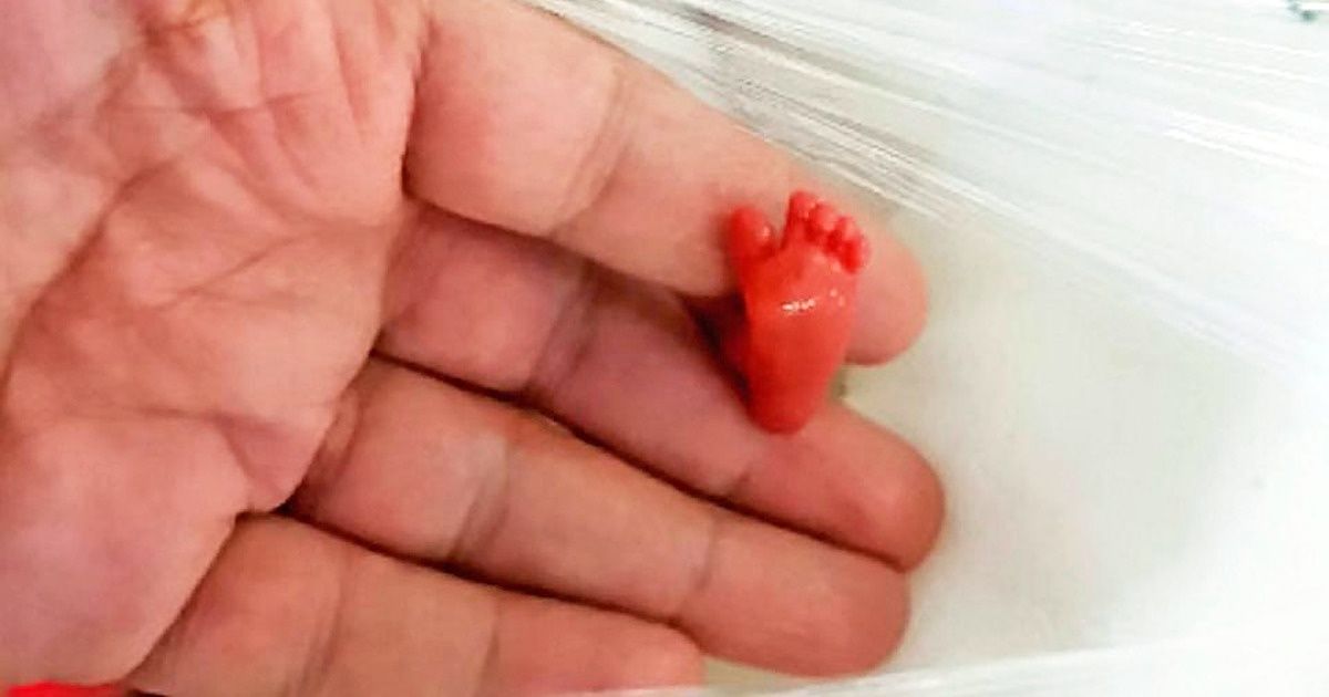 18 Photos That Are So Powerful, They Leave a Lasting Impression on You 18 Photos That Are So Powerful, They Leave a Lasting Impression on You