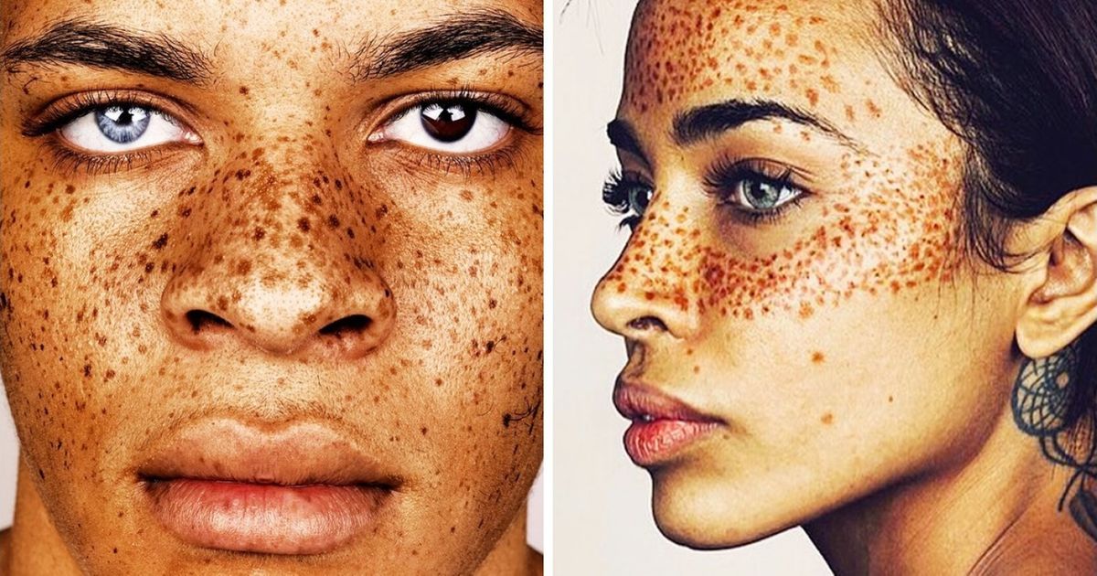evigt Døds kæbe trone An English Photographer Captures the Beauty of People with Unique Skin  Conditions in a Massive Portrait Project / Bright Side