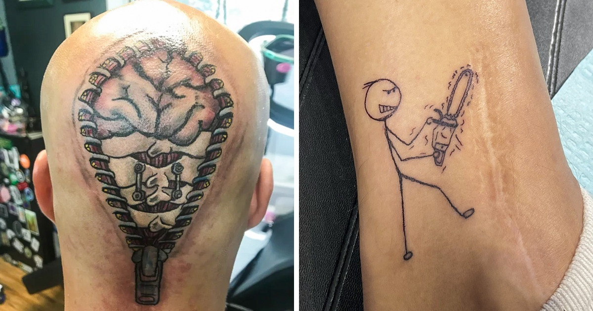16 People Who Used the Art of Tattoos to Cover Up Their Scars / Bright Side