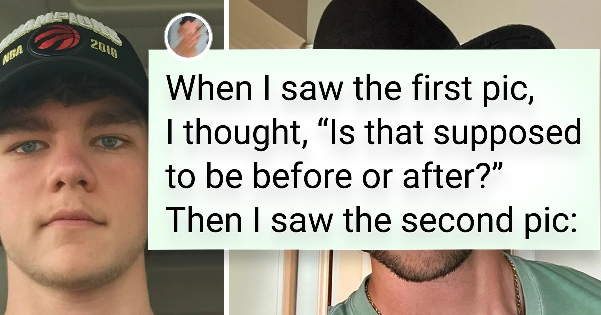 18 People Who Decided to Share the Results of Their Teenage Transformations