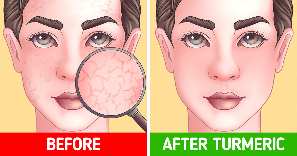 What Happens to Your Body If You Drink Turmeric Shots Every Day What Happens to Your Body If You Drink Turmeric Shots Every Day