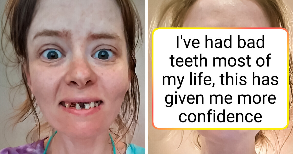 15 People Who Deserve to Be Called the Winners of Transformation 15 People Who Deserve to Be Called the Winners of Transformation