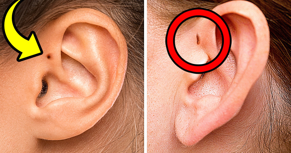 Your Ears May Reveal How Rare You Are + 10 Unique Body Features Your Ears May Reveal How Rare You Are + 10 Unique Body Features