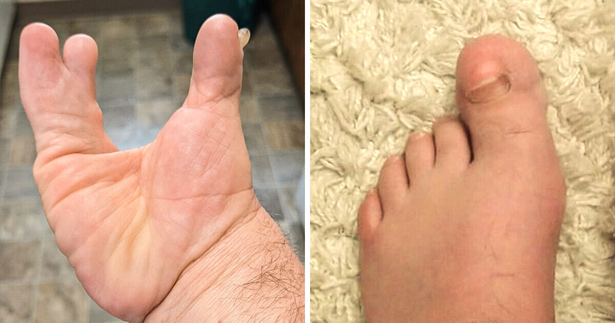 15 People Who Prove You Should Embrace Your Unique Body Traits