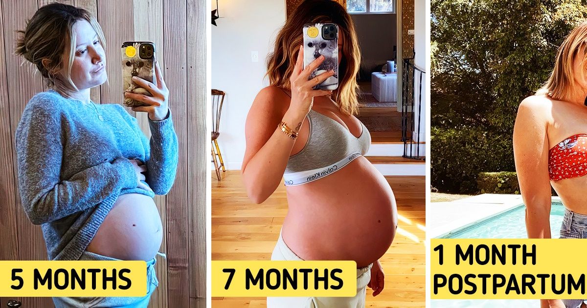 10 Famous Women Who Got Real About the Imperfections of Their Post-Baby  Body / Bright Side