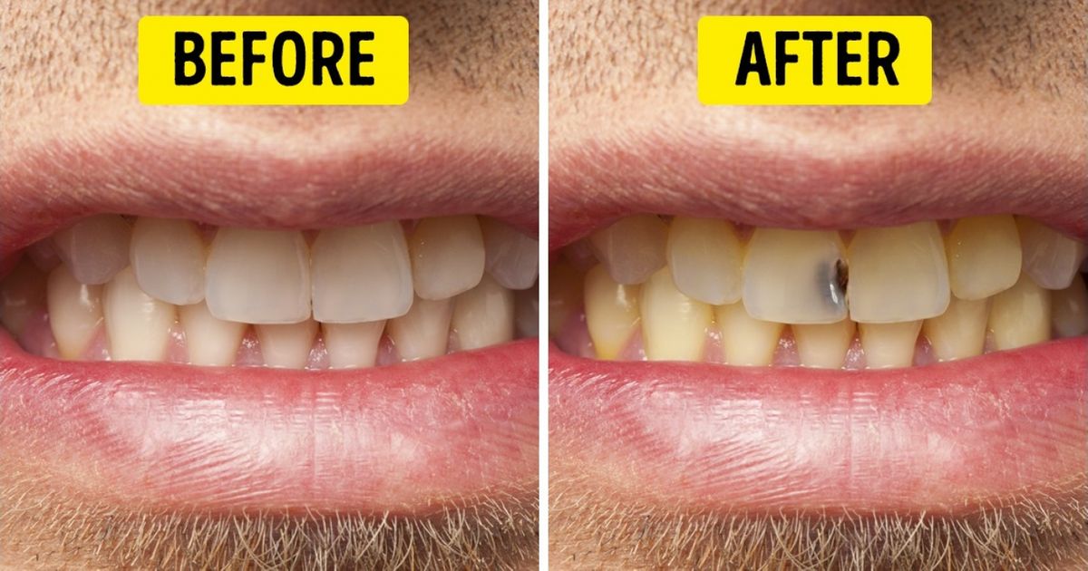9 Everyday Habits It’s Better Get Rid of as Soon as Possible