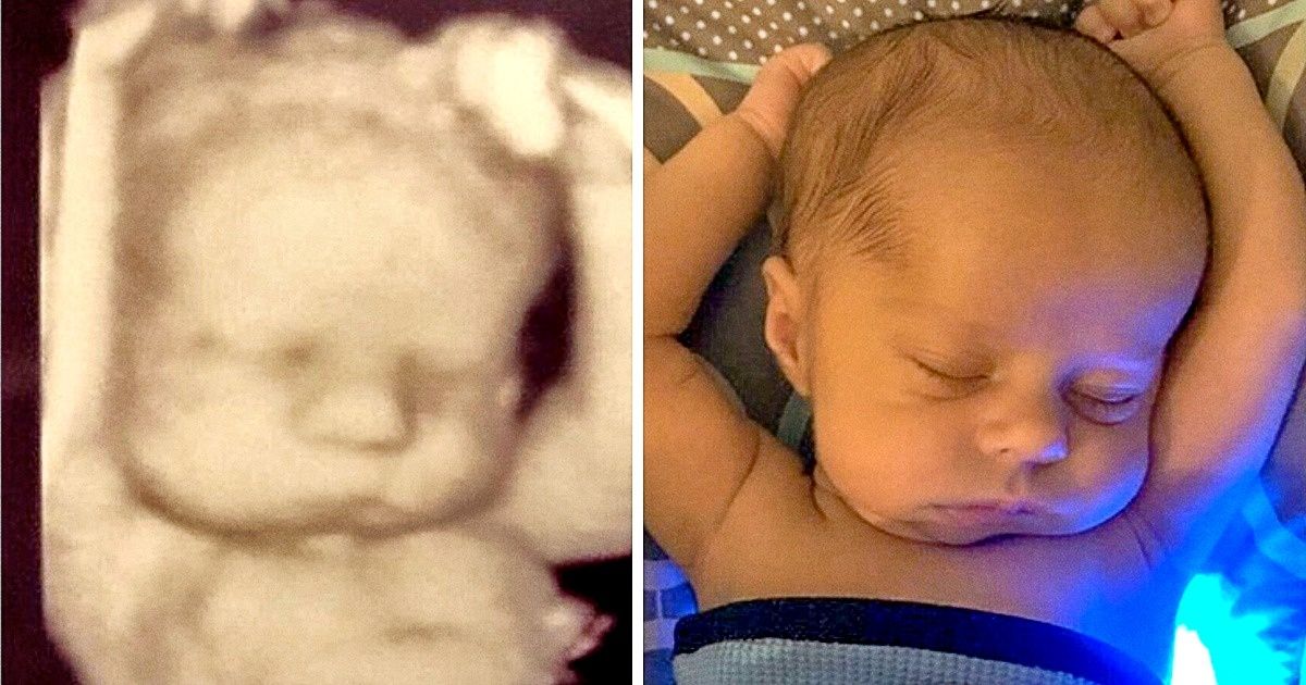 25 ’Before and After’ Photos That Are Difficult to Tear Our Eyes Away From