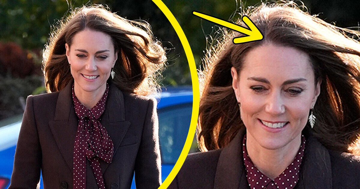 Why Princess Catherine Might Have Saved Her Hair Despite Chemo Why Princess Catherine Might Have Saved Her Hair Despite Chemo