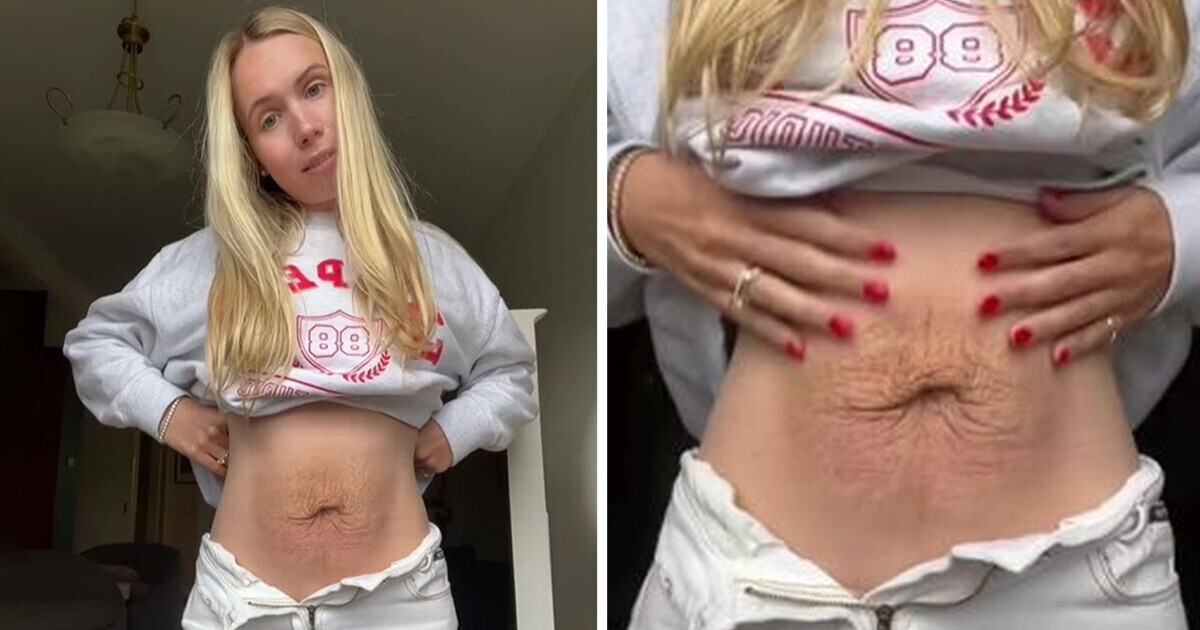 A Young Mom Reveals How Pregnancy Actually Changes Your Body