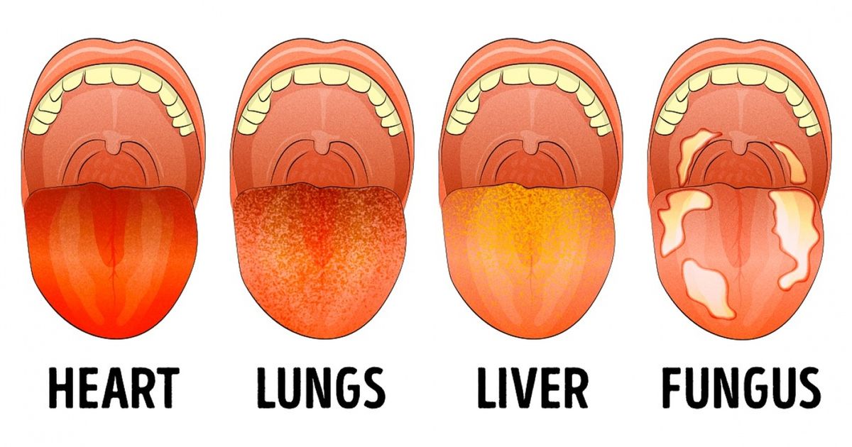 9 Things Your Tongue Is Trying to Tell You About Your Health 9 Things Your Tongue Is Trying to Tell You About Your Health