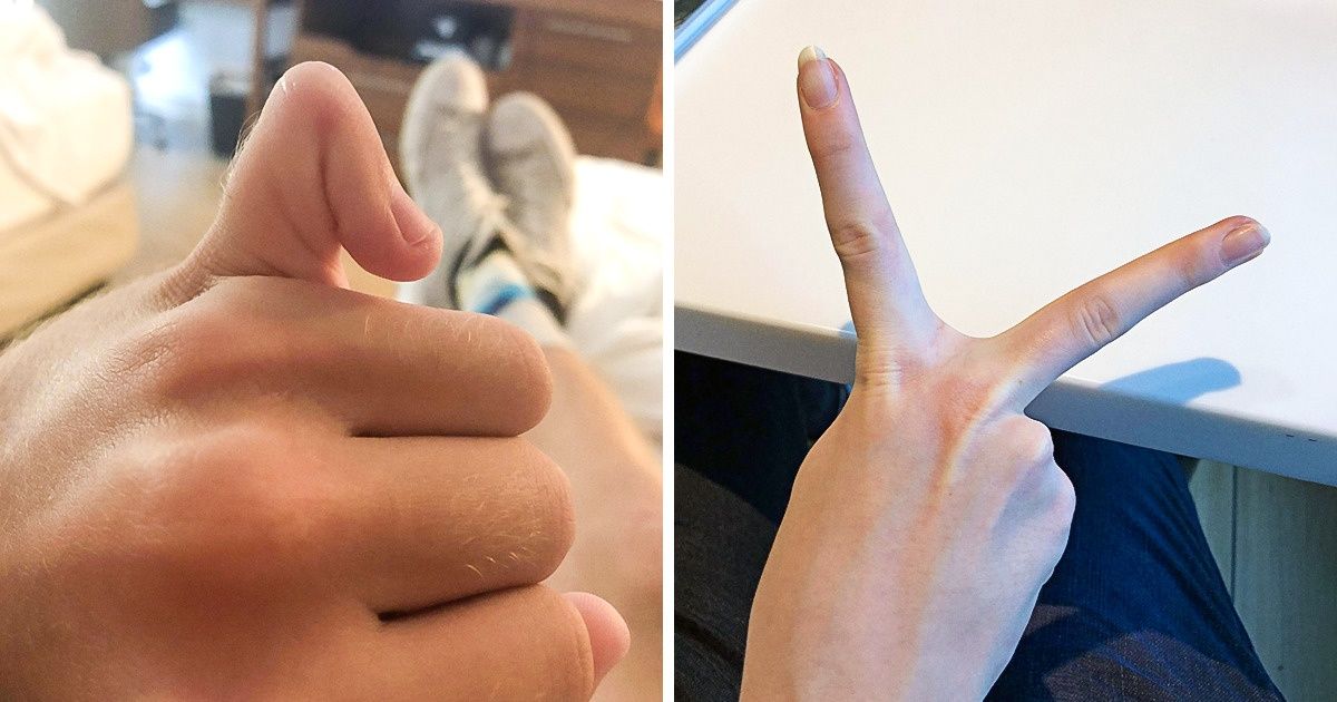 20 People Whose Bodies Are an Endless Source of Wonder