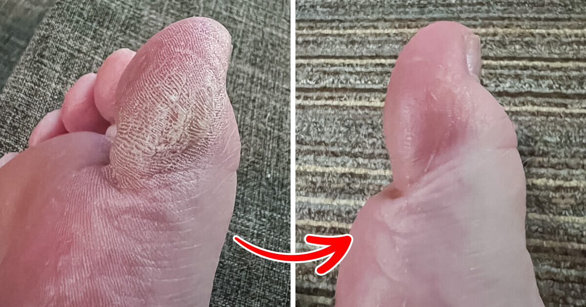 10 personal care items from Amazon with truly inspiring before and afters 10 personal care items from Amazon with truly inspiring before and afters