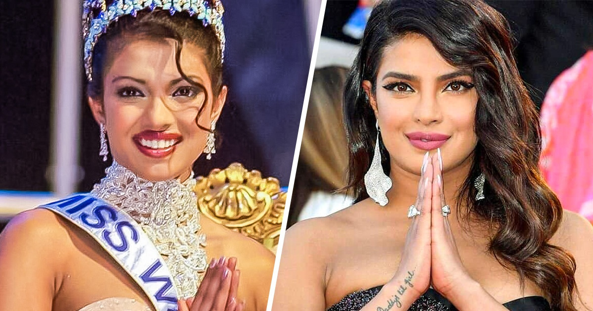 “Every Time I Looked in the Mirror, I Saw a Stranger,” How Priyanka Chopra Managed to Accept Herself After the Complications of a Medical Surgery