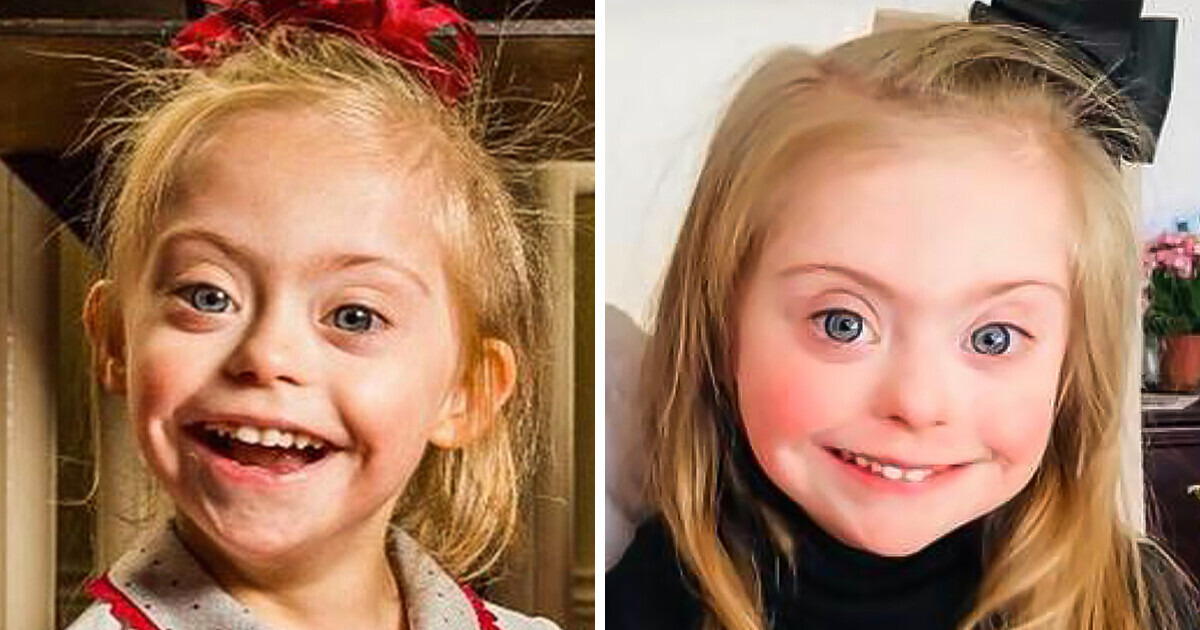 A Toddler With Down Syndrome Who Stole People’s Hearts With Her Smile, Gets Showered With Modeling Contracts A Toddler With Down Syndrome Who Stole People’s Hearts With Her Smile, Gets Showered With Modeling Contracts