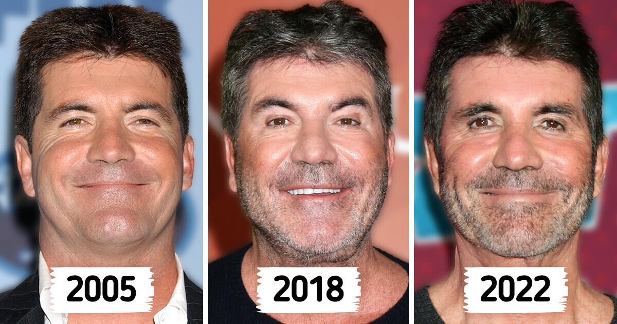 Enough Was Enough,” Simon Cowell Ditched Botox After His Son Got Hysterical  Over His Overfilled Face / Bright Side